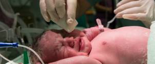 Neonatal Sepsis