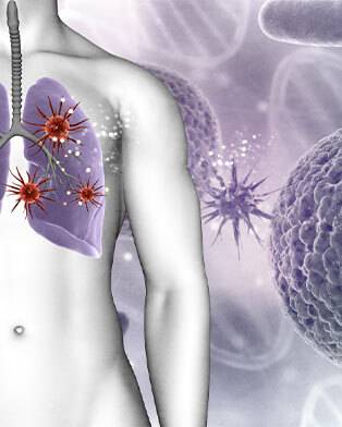 Sepsis – Signs, Symptoms and Treatment