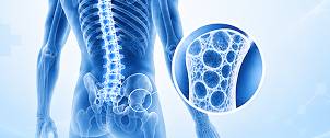 Advancing Osteoporosis Care in Men: Diagnosis, Therapeutic Sequencing, and Patient Centered Management