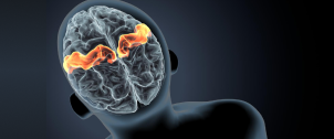 Patient Perspective on Epilepsy