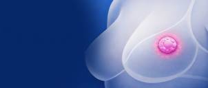 Ovarian Function Suppression in the Treatment of Premenopausal Women with Breast Cancer : Highlights from the September 2025 Meeting