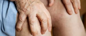 Rheumatology Updates - Rheumatoid Arthritis, Gout, CCPD, and Systemic Lupus Erythematosus(SLE)