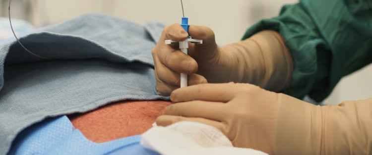 McMaster PD Access Centre by SJHH (MPACS) Intro PD Catheter Insertion Course