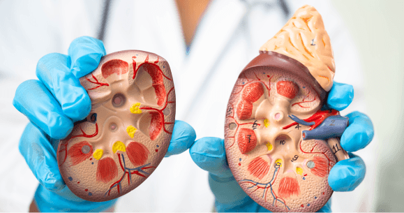 Renal Pharmacotherapy-Managing Chronic Kidney Disease