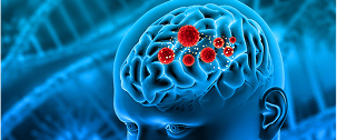 Central Nervous System Tumors – Move Towards Precision Medicine
