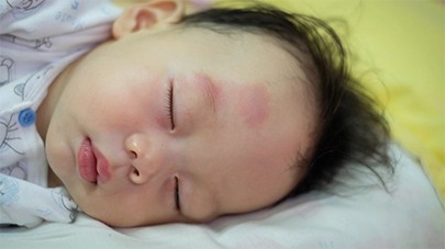Pediatric Skull Radiograph Interpretation