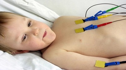 Pediatric Electrocardiogram Interpretation