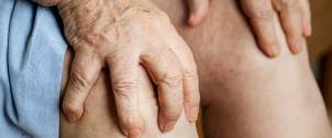 Rheumatoid Arthritis: Pathogenesis, Complications and Treatment recommendations
