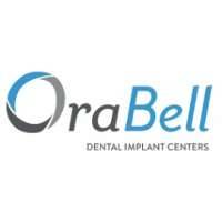OraBell Dental Implants