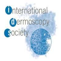 International Dermoscopy Society (IDS)
