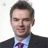 Steve Allder